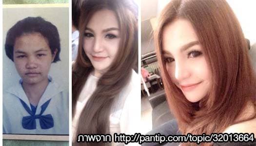 ศัลยกรรมเปลี่ยนชีวิต! สาวฮึดทำสวย หลังโดนผู้ชายปฏิเสธไม่รับรัก 