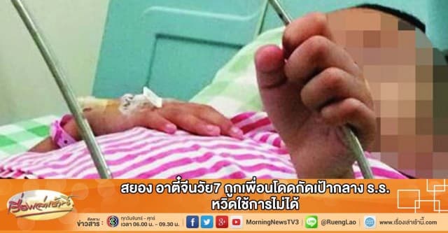 สยอง อาตี๋จีนวัย7 ถูกเพื่อนโดดกัดเป้ากางเกงกลาง ร.ร. หวิดใช้การไม่ได้