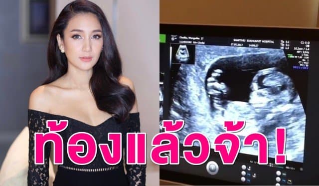 ท้องแล้วจ้า! 'เนย โชติกา' ประกาศข่าวดีตั้งท้องลูกคนแรกแล้ว พร้อมเผยคลิปอัลตราซาวด์