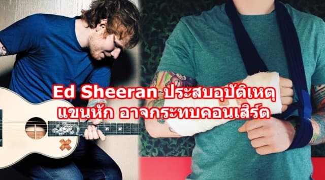 นักร้องดัง Ed Sheeran ประสบอุบัติเหตุขณะปั่นจักรยาน แขนหัก เจ้าตัวโพสต์อาจกระทบคอนเสิร์ต