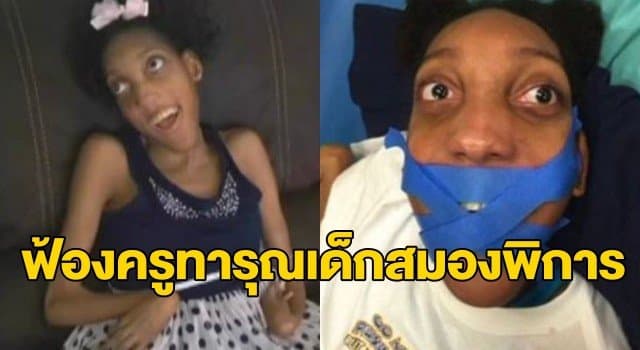 ครอบครัวสาวสหรัฐฯ ป่วยสมองพิการฟ้องโรงเรียน หลังเคยถูกครูทารุณ ‘สาดกาแฟร้อนใส่-ใช้เทปกาวปิดปาก’