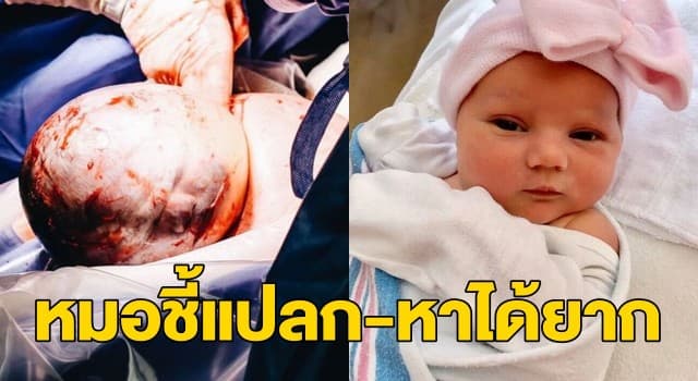 พ่อสหรัฐฯ เผยภาพวินาทีชวนทึ่ง ลูกสาวคลอดออกมาพร้อมถุงน้ำคร่ำ 