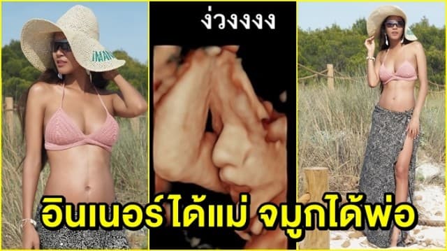 ‘เมญ่า’ โชว์ภาพอัลตราซาวด์ลูกน้อย โพสต์ท่าง่วงสุดเป๊ะ ‘อินเนอร์ได้แม่ จมูกได้พ่อ’