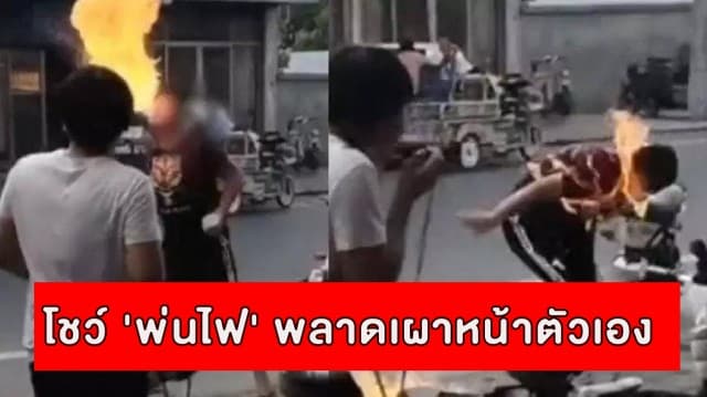 โจ๋จีนโชว์ 'พ่นไฟ' พลาดเผาหน้าหวิดดับ บทเรียนเด็กอยากลองของ!