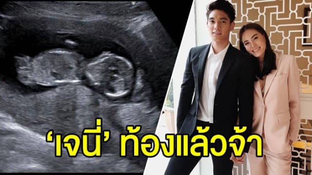 ท้องแล้วจ้า! ‘เจนี่’ ประกาศข่าวดี ตั้งท้องลูกคนแรกแล้ว