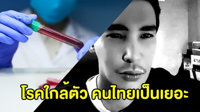 รู้จักโรคอันตรายคร่าชีวิต ‘นาธาน โอมาน’ อ่อนเพลีย ใจสั่น ส่งต่อกรรมพันธุ์ แพทย์เผยวิธีป้องกัน