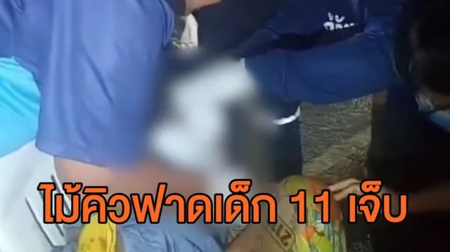 มือสนุ๊กหัวร้อน! แทงไม่ได้ดั่งใจ ใช้ไม้คิวฟาดหัวเด็ก 11 ขวบ 