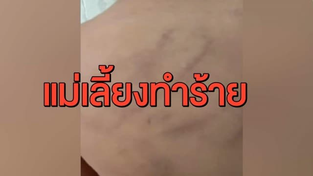 พ่อพาลูกวัย 7 ขวบไปเที่ยววันเด็ก ส่งกลับบ้านแม่เจอแผลเต็มตัว เค้นถามจนลูกรับ ถูกแม่เลี้ยงตีไม่ยั้ง