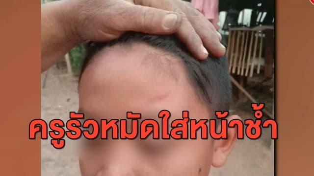 แม่สุดทน ลูกม.1 ถูกครูต่อยหน้าช้ำ เหตุเพราะเล่นกับเพื่อนพลาดเหยียบเท้าครู