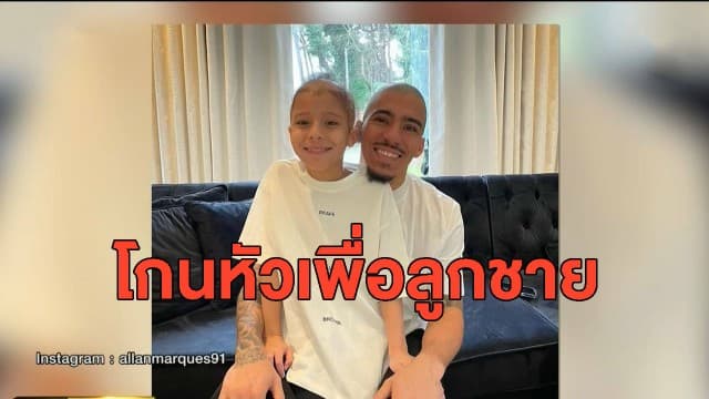 สุดน่ารัก! 'อัลลัน' แข้งเอฟเวอร์ตัน โกนหัวเป็นเพื่อนลูกชายที่ป่วยจนผมร่วง