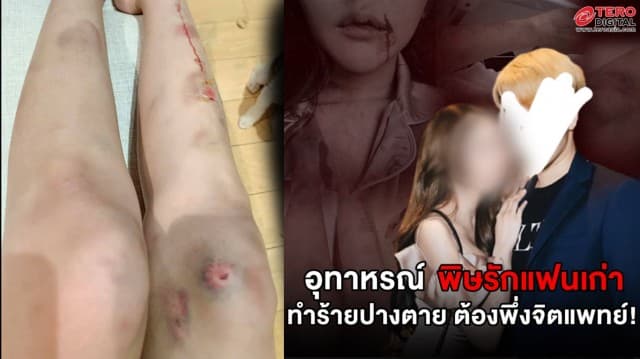 อุทาหรณ์! สาวแชร์ประสบการณ์ช้ำ 'พิษรักแฟนเก่า' ถูกทำร้ายปางตาย อายจนต้องพบจิตแพทย์