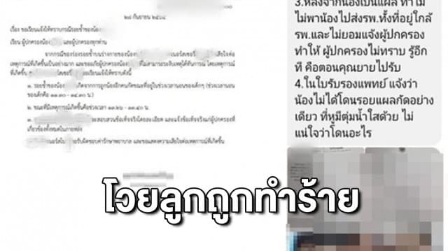 แม่โวย ลูก 1 ขวบ ถูกทำร้ายในเนิร์สเซอรี ขอดูวงจรปิด อ้างกล้องเสีย