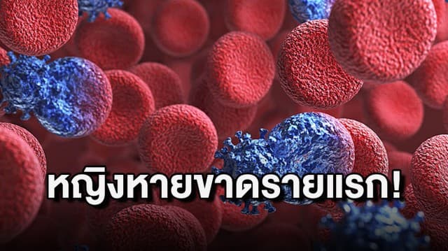 สหรัฐฯ พบ หญิงรายแรกหายขาดจาก HIV จากการปลูกถ่ายสเต็มเซลล์   