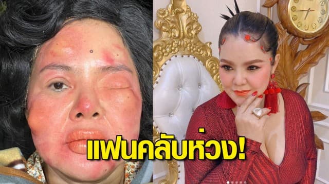 ฮาย อาภาพร โพสต์ภาพหน้าตาบวมปูดกลางดึก แฟนคลับห่วง! คอมเมนต์ถามรัว