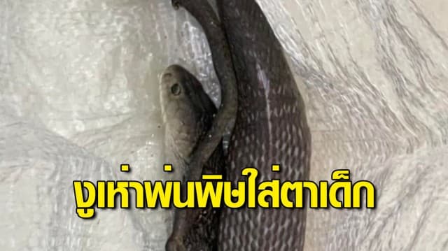 อุทาหรณ์ เด็ก 3 ขวบเข้าห้องน้ำ ถูกงูเห่าพ่นพิษใส่ตา ล่าสุดปลอดภัย