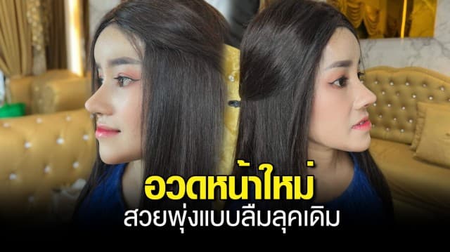 หนูรัตน์ เน็ตไอดอลดัง โพสต์อวดหน้าใหม่หลังทำศัลยกรรม สวยพุ่งแบบลืมลุคเดิม