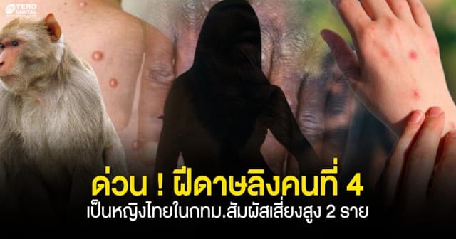 ด่วน ! พบผู้ป่วย "ฝีดาษลิง" รายที่ 4 หญิงไทยในกทม.สัมผัสเสี่ยงสูง 2 ราย