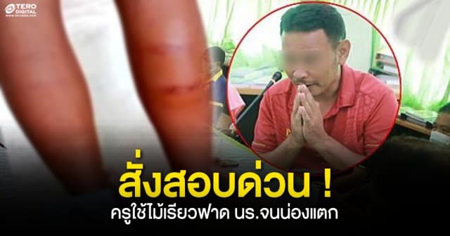 สั่งสอบด่วน ! ครูประจำชั้น ใช้ไม้เรียวฟาดนักเรียน จนน่องแตก