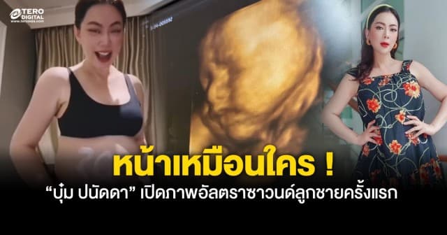 บุ๋ม ปนัดดา เผยภาพอัลตราซาวนด์ เตรียมคลอดลูกชายคนแรก ลั่นหน้าเหมือนใคร ?