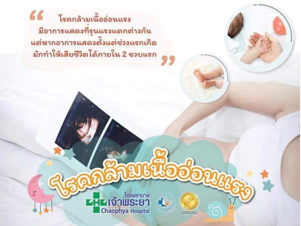 โรคกล้ามเนื้ออ่อนแรง (Spinal Muscular Atrophy : SMA) ภัยร้ายที่มากับพันธุกรรม