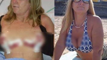 ช็อก! แหม่มอังกฤษอกระเบิด หลังอัพอึ๋มไซส์บิ๊กเบิ้ม "ดับเบิ้ลดี"