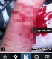 แอนตี้หนัก! แฟนคลับรับไม่ได้ ไอดอลเกาหลีมีแฟน โชว์ภาพกรีดข้อมือแท็กไอจีไอดอล 