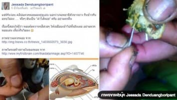 เงิบ! อ.จุฬาฯ แจงอย่าแตกตื่น คลิปแหวกหอยแมลงภู่เจอพยาธิ ที่แท้แค่ลำไส้