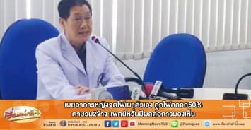 เผยอาการหญิงจุดไฟเผาตัวเอง ถูกไฟคลอก50% ตาบวม2ข้าง แพทย์หวั่นมีผลต่อการมองเห็น