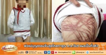 พ่อแม่บุญธรรมจีนสุดโหดทารุณ ด.ช.วัย9 แผลเป็นทั่วตัว