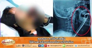 สุดสยอง สาวจีนหวิดดับ ใช้ด้ามตะหลิวแหย่คอหลังหายใจขัดข้อง