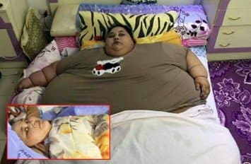 เผยภาพล่าสุด สาวอียิปต์ป่วยหนักเกือบ 500 กิโล หลังบินรักษาตัวที่อินเดีย หวังผ่าตัดลดความอ้วน