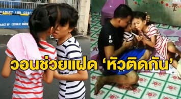 พ่อแม่ฟิลิปปินส์วอนช่วยลูกแฝด ‘หัวติดกัน’ หลังใช้ชีวิตยากลำบากมานาน 10 ปี  หมอรับผ่าตัดแยกเสี่ยงตายสูง