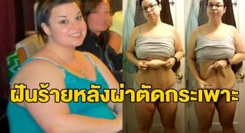 สาวมะกันอ้วน 140 กก. แชร์ประสบการณ์หมดเงินกว่า 3 ล้านผ่าตัดกระเพาะให้ผอม แต่กลับต้องเจอกับฝันร้าย