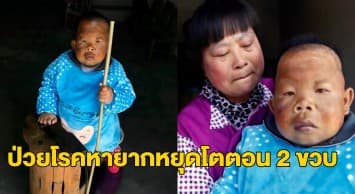 แม่จีนอุทิศชีวิตเลี้ยงลูกชายวัย30 แต่โตเท่าเด็กหัดเดิน เผยหมอเคยบอกว่าจะอยู่ไม่ถึงสามสิบ