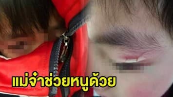 (คลิป) เจ็บ! กู้ภัยเข้าช่วยเด็กจีน 'ซิปหนีบหนังตา' หลังรีบถอดเสื้อกันหนาวเกินเหตุ