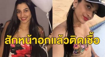 สาวโคลอมเบียวัย16 เผยอุทาหรณ์ ‘แท้งลูก-เดินไม่ได้’ หลังติดเชื้อจากการสัก