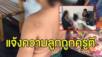 แม่แจ้งความ ลูกสาววัย 5 ขวบ ถูกครูตีมีรอยช้ำ ยัน เอาเรื่องให้ถึงที่สุด