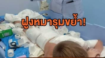 ฝูงหมารุมขย้ำเด็กฝรั่ง วัย 7 ขวบ เจ็บทั่วร่าง ขณะวิ่งกับพ่อที่ริมหาด จ.กระบี่