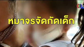 โผล่อีก! สุนัขจรจัดขย้ำเด็ก 4 ขวบใบหน้าเย็บ 7 เข็ม แม่วอนหน่วยงานเข้าช่วย หวั่นซ้ำรอย