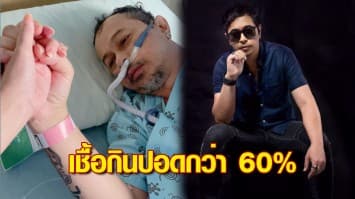 'มอร์ มอร์กระจาย' นักร้องดังยุค 90 ติดโควิด เชื้อกินปอดกว่า 60% 