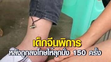 สลด! นักเรียนหญิงแดนมังกร ต้องพิการถาวร หลังถูกลงโทษให้ลุกนั่ง 150 ครั้ง