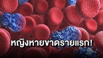 สหรัฐฯ พบ หญิงรายแรกหายขาดจาก HIV จากการปลูกถ่ายสเต็มเซลล์   