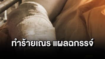 ญาติร้องสื่อ หลานบวชเรียนเป็น "สามเณร" ถูก "เจ้าวาส" ทำร้ายร่างกายได้รับแผลฉกรรจ์ เย็บ 6 เข็ม