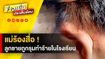 แม่ร้องสื่อ ! ลูกชายถูกรุมทำร้ายบาดเจ็บ แต่โรงเรียนปล่อยผ่าน ผอ.อ้าง "ไม่สะดวก"