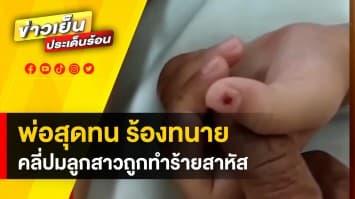 สุดทน ! พ่อเด็ก 3 ขวบ ร้อง ทนายรณณรงค์ ปมลูกสาวถูกทำร้าย เจ็บสาหัส