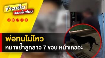 พ่อทนไม่ไหว ! ลูกสาว 7 ขวบ ถูกหมาขย้ำหน้าเหวอะหวะ ไร้การรับผิดชอบ