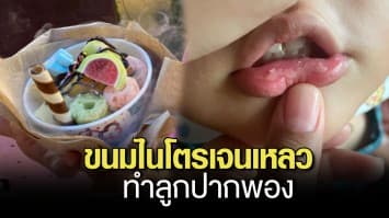 อุทาหรณ์ แม่โพสต์เตือนลูกน้อยกินขนมไนโตรเจนเหลว ทำลูกปากพอง