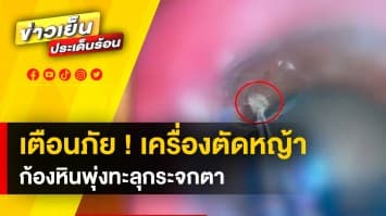 อุทาหรณ์ ! ใช้เครื่องตัดหญ้า ไม่สวมแว่นป้องกัน ก้อนหินพุ่งทะลุกระจกตา หวิดตาบอด