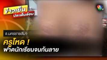 ครูโหด ! ตีนักเรียน 26 ครั้ง จนก้นลาย สุดท้ายไหว้สวยขอโทษผู้ปกครอง