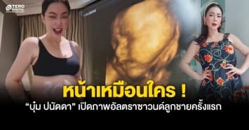 บุ๋ม ปนัดดา เผยภาพอัลตราซาวนด์ เตรียมคลอดลูกชายคนแรก ลั่นหน้าเหมือนใคร ?